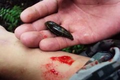 螞蟥咬人怎么辦？螞蟥怎么能殺死？